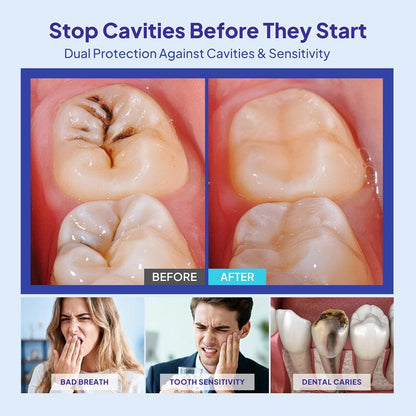 Dental Tooth Armor